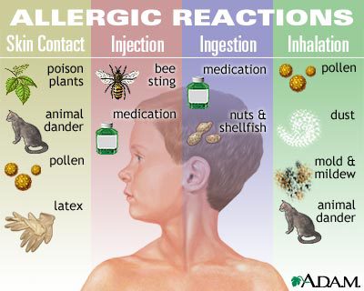 What Causes Allergies