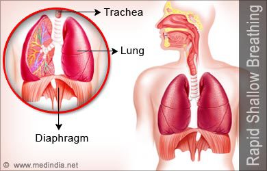 Risk of respiratory infections